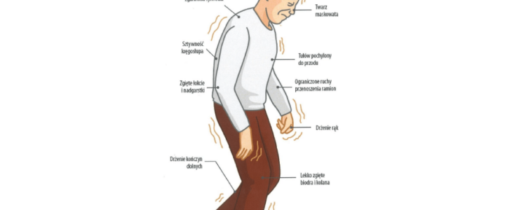 Parkinson-1