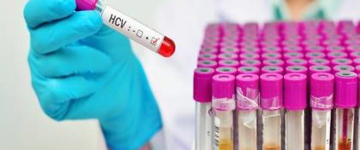 Laboratorium Szpitala Miejskiego w Świnoujściu zaprasza